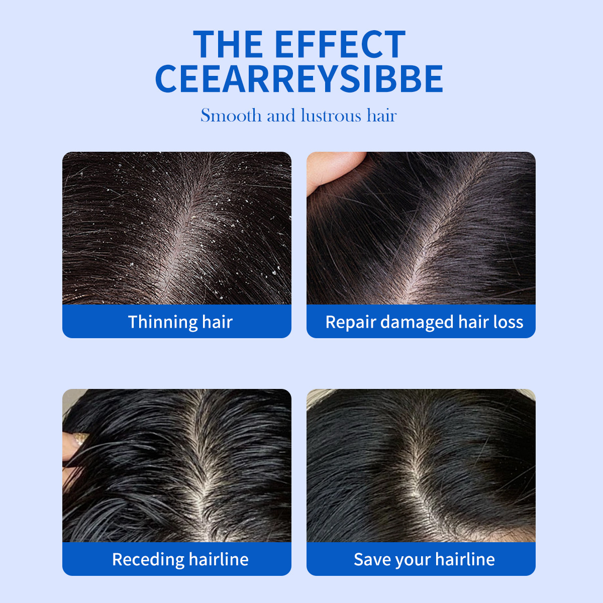 325ml Selenium Disulfide Anti  - Hair Care Dandruff 评论和价格