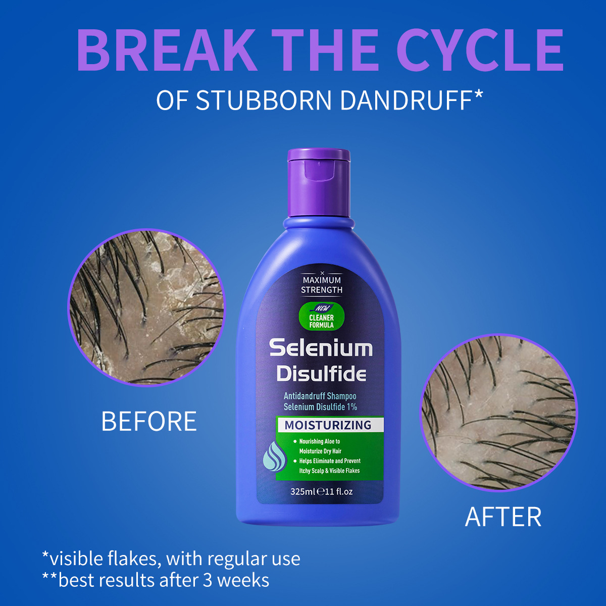 325ml Selenium Disulfide Anti  - Hair Care Dandruff 评论和价格